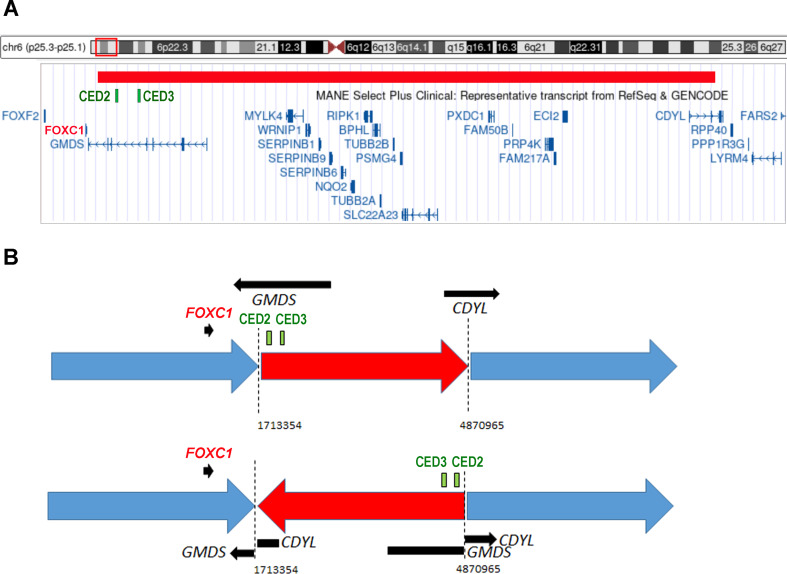 Displacement of distant regulatory elements of FOXC1 as a potential human disease mechanism.