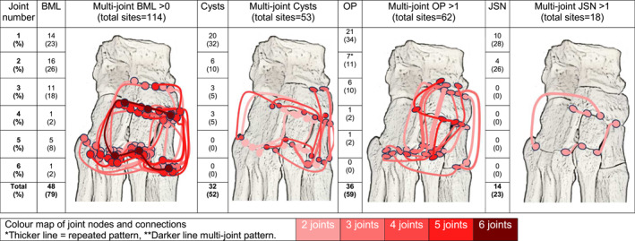 Association between clinical and MRI-detected imaging findings for people with midfoot pain, a cross-sectional study.