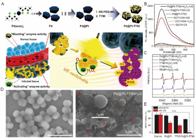 Antibacterial sonodynamic nanomedicine: mechanism, category, and applications.