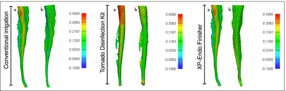 Micro-CT Analysis of an Abrasive-expanding System of Oval Canal Debridement Capacity: Laboratory Study.