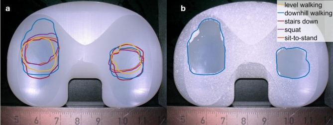 Transfer of patients' tibiofemoral kinematics and loads to a six-degree-of-freedom (6-DOF) joint simulator under consideration of virtual ligaments.