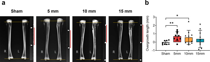 The effect of metaphyseal holes and interposition material on the longitudinal growth stimulation of long bones in a rabbit model.