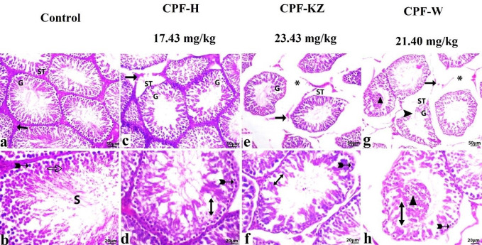 The effect of an organophosphorus pesticide, chlorpyrifos (from different local sources), on the testicular tissue in adult male albino rats.