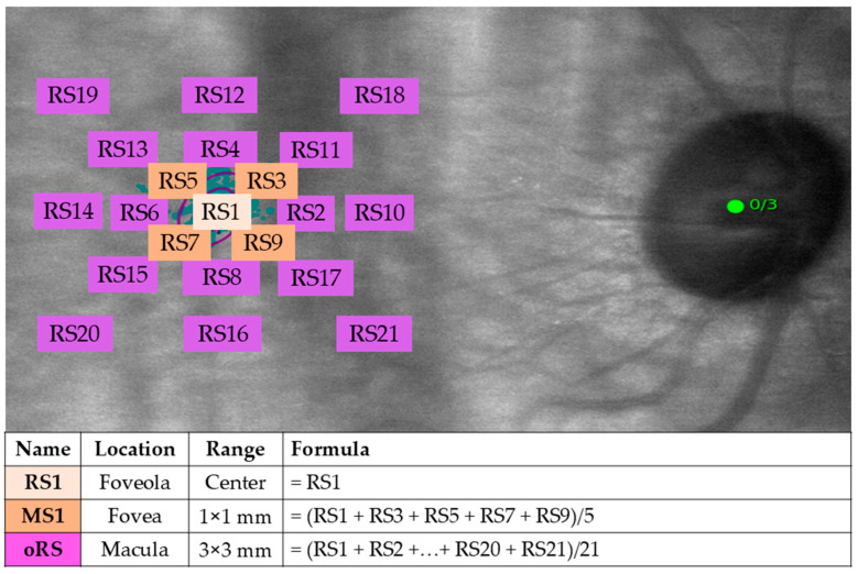 Characterizing the Preferred Retinal Locus and Fixation Stability in Diabetic Macular Ischemia: A One-Year Study.