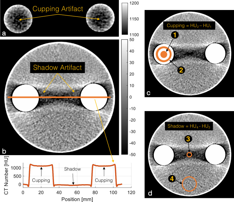 Beam hardening of K-edge contrast agents: a phantom study comparing clinical energy-integrating detector and photon-counting detector CT systems.