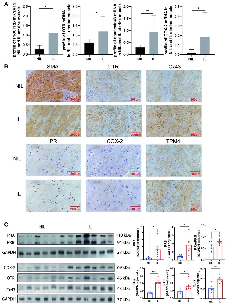 LncRNA GAS5 Regulates Myometrial Cell Contractions in an m6A-Dependent Manner.