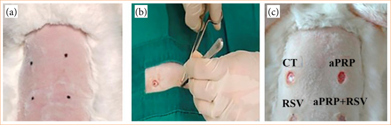 Type I and type III collagen immunoexpression in rabbit skin biopsy samples treated with rosuvastatin gel and autologous platelet-rich plasma.