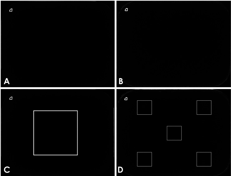 Comparison of objective radiograph quality between radiographs obtained with wall-mounted and handheld X-ray devices.