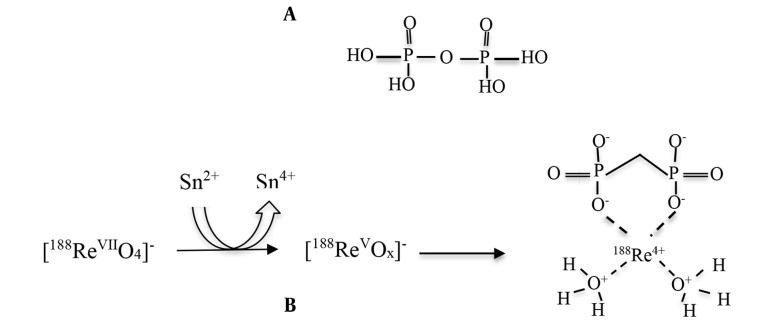 Development of a Potential Bone-Seeking Radiopharmaceutical by Sodium Pyrophosphate Labeled <sup>188</sup>Rhenium (<sup>188</sup>Re-PYP) for Bone Pain Palliation.