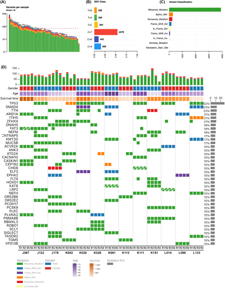 Whole exome sequencing of multi-regions reveals tumor heterogeneity in Opisthorchis viverrini-associated cholangiocarcinoma.