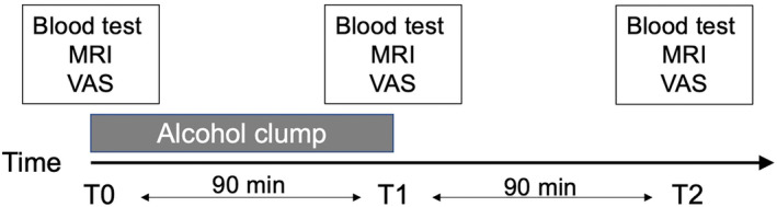 Effects of short-term exposure to moderate amounts of alcohol on brain volume.
