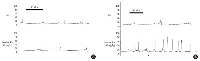Effect of Acotiamide on Detrusor Underactivity Induced Through Bilateral Pelvic Nerve Crush Injury in Rats.