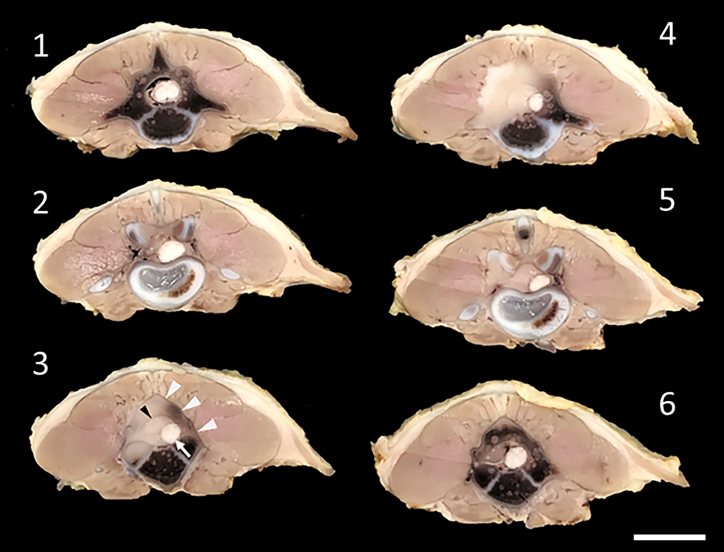 Lumbar round cell sarcoma in a 10-week-old rottweiler puppy.