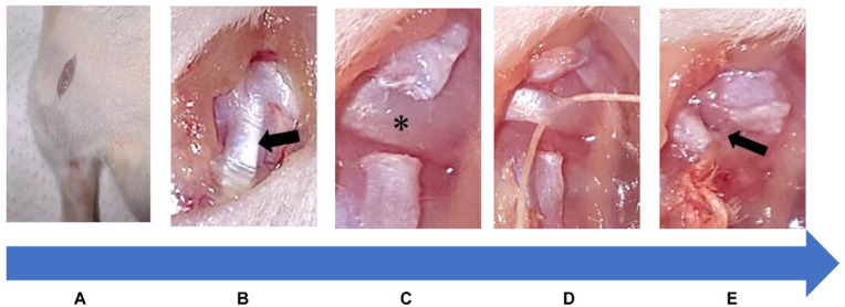 Development of a Novel Rat Knee Osteoarthritis Model Induced by Medial Meniscus Extrusion.