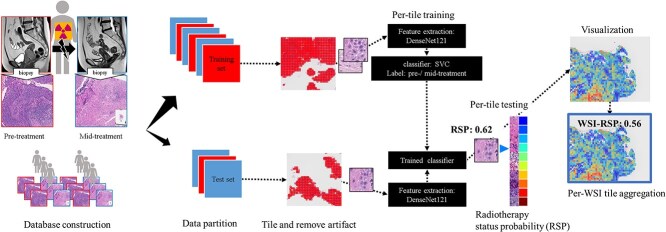 Development of a deep learning-based model to evaluate changes during radiotherapy using cervical cancer digital pathology.