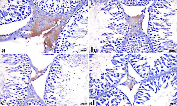The effect of an organophosphorus pesticide, chlorpyrifos (from different local sources), on the testicular tissue in adult male albino rats.
