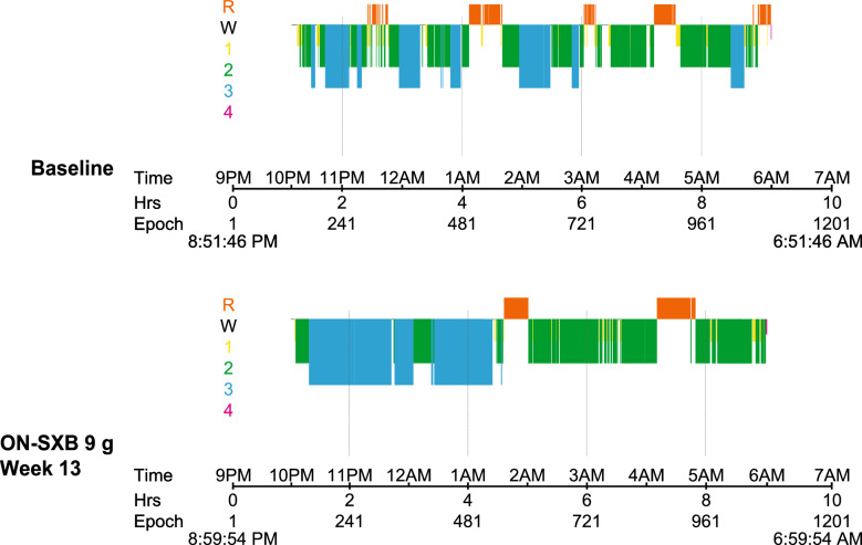 Therapeutic Use of γ-Hydroxybutyrate: History and Clinical Utility of Oxybates and Considerations of Once- and Twice-Nightly Dosing in Narcolepsy.