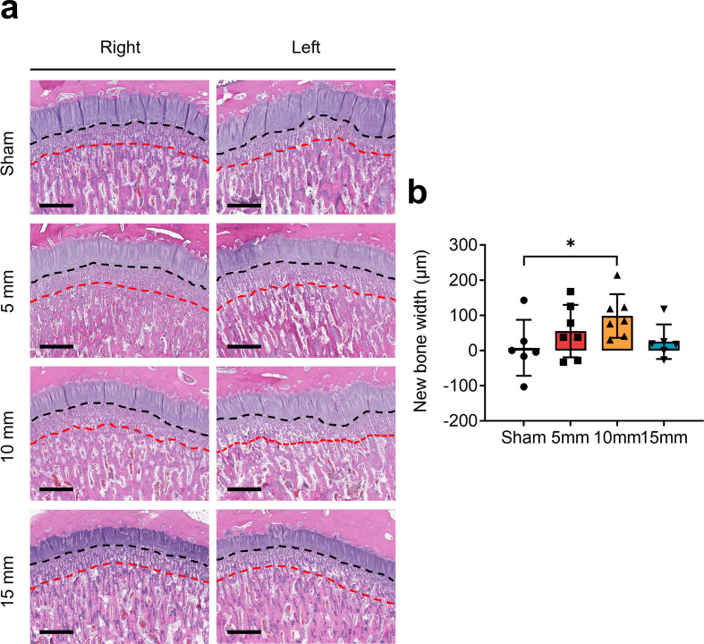 The effect of metaphyseal holes and interposition material on the longitudinal growth stimulation of long bones in a rabbit model.