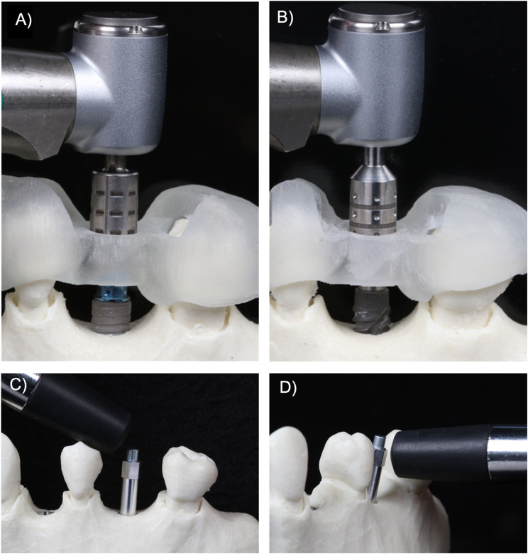 Primary implant stability of two implant macro-designs in different alveolar ridge morphologies: an in vitro study.