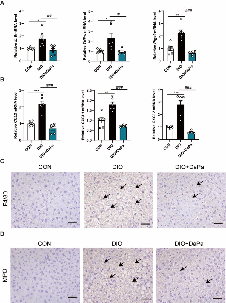 Dapagliflozin attenuates metabolic dysfunction-associated steatotic liver disease by inhibiting lipid accumulation, inflammation and liver fibrosis.