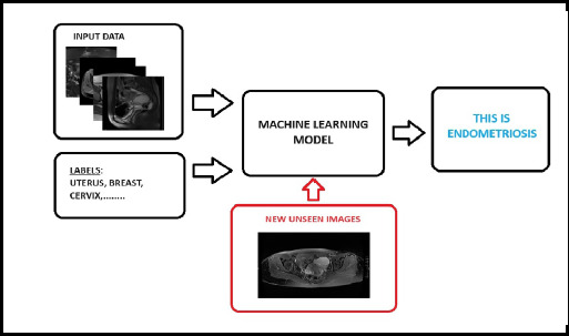 Current Status and Future Potential of Machine Learning in Diagnostic Imaging of Endometriosis : A Literature Review.