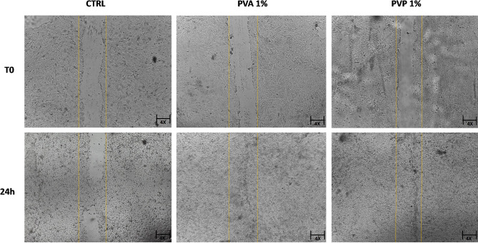 PVA and PVP nanofibers combined with Helichrysum italicum oil preserve skin cell interactions, elasticity and proliferation.