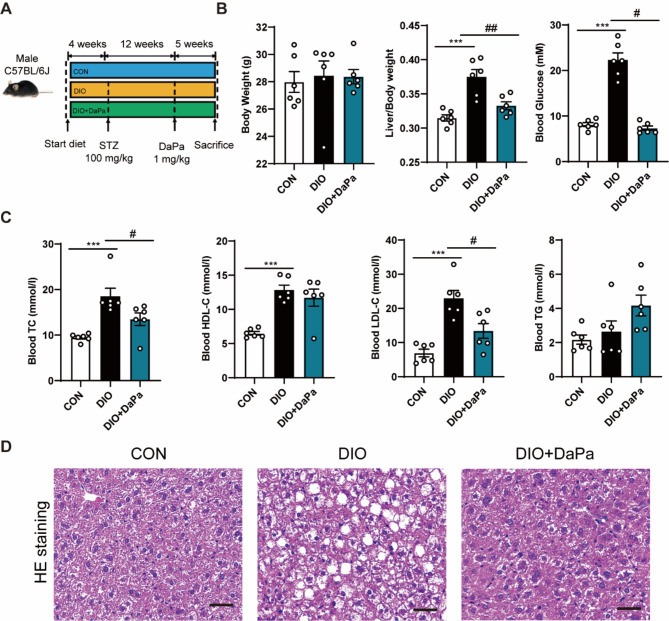 Dapagliflozin attenuates metabolic dysfunction-associated steatotic liver disease by inhibiting lipid accumulation, inflammation and liver fibrosis.