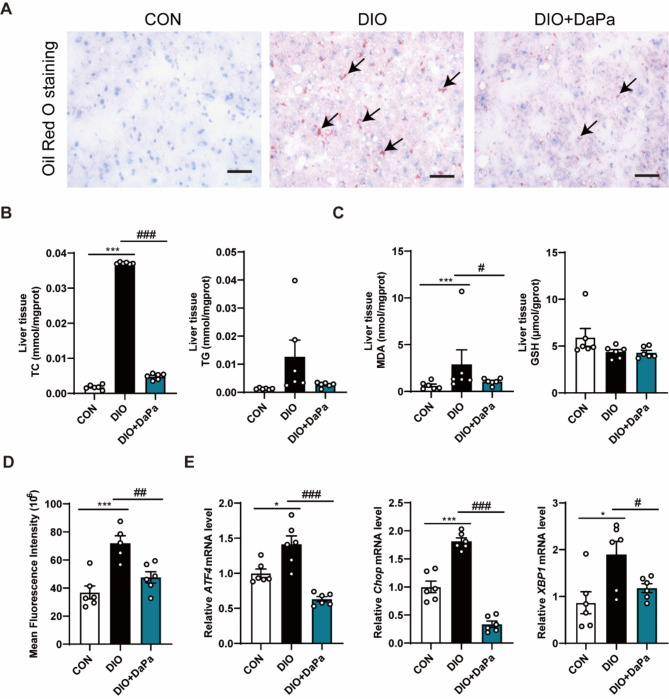 Dapagliflozin attenuates metabolic dysfunction-associated steatotic liver disease by inhibiting lipid accumulation, inflammation and liver fibrosis.