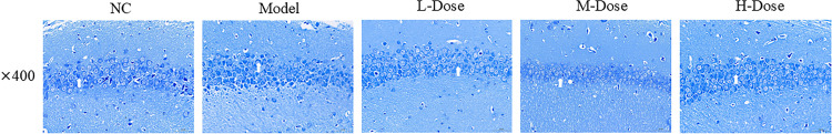 Anti-inflammatory and antioxidant effects of fenugreek in preventing mice model of Alzheimer's disease.