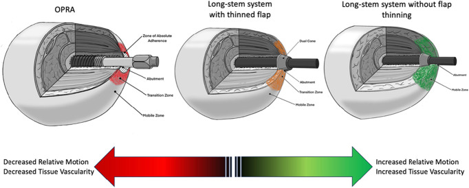 A conceptual framework for soft tissue management of transdermal bone-anchored implants in extremity prostheses.