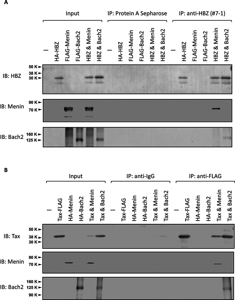 Dysregulation of the tumor suppressor Menin and its target Bach2 in HTLV-1 infection.