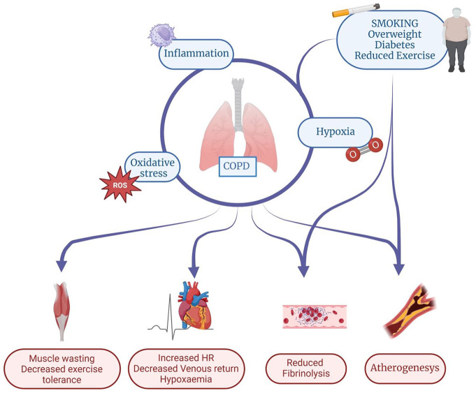 Biological pathways and mechanisms linking COPD and cardiovascular disease.