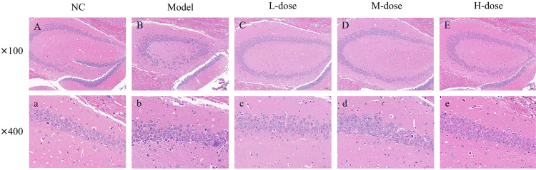 Anti-inflammatory and antioxidant effects of fenugreek in preventing mice model of Alzheimer's disease.