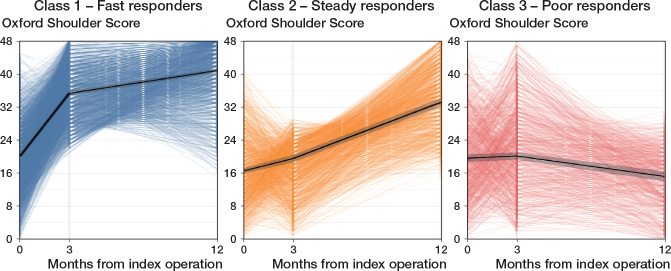 Identifying recovery trajectories following primary total shoulder arthroplasty: a cohort study of 3,358 patients from the Dutch Arthroplasty Register.