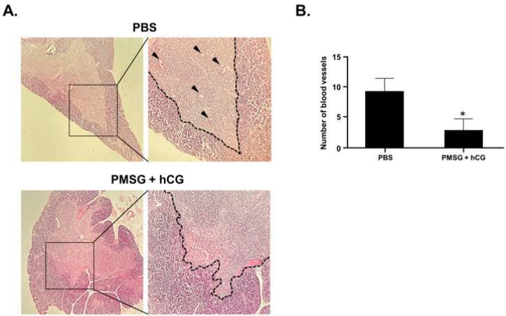Repeated Gonadotropin Administration Suppresses T Cell Development in the Mouse Thymus.