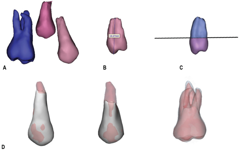 Orthodontic Forces Interrupt Root Formation in Immature Teeth: Myth or Fact? A Pilot Study.