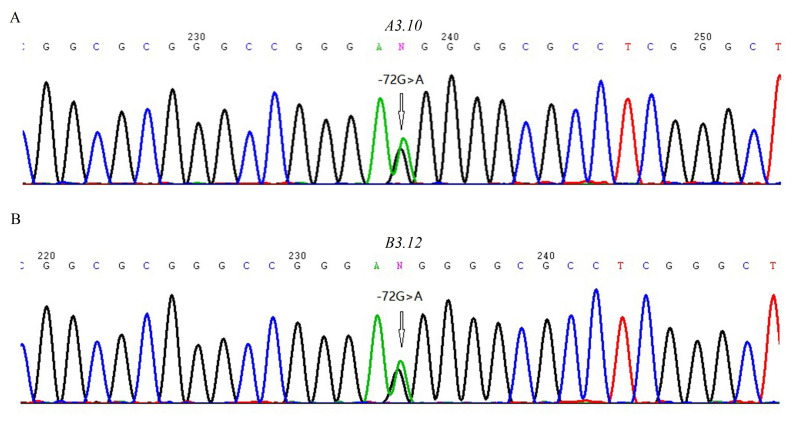The -72G>A nucleotide substitution impairs transcription of the ABO gene via reduction of promoter activity.
