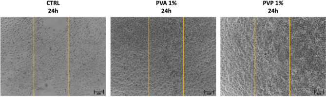 PVA and PVP nanofibers combined with Helichrysum italicum oil preserve skin cell interactions, elasticity and proliferation.