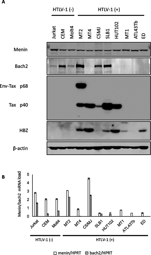 Dysregulation of the tumor suppressor Menin and its target Bach2 in HTLV-1 infection.
