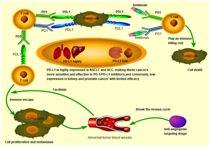 Research progress of sintilimab in the treatment of cancer (Review).