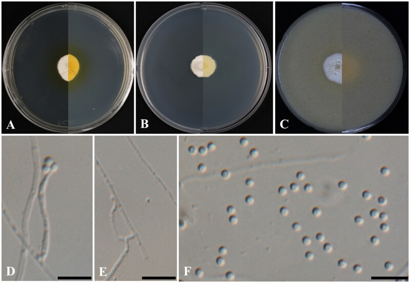 <i>Microascus microspora</i> sp. nov. and <i>Tolypocladium terrae</i> sp. nov.; Two Novel Fungal Species Isolated from Soil in Korea.