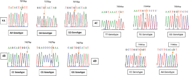 Fatty acids profile in Awassi sheep milk affected by some genes' single and combined effects.
