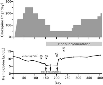 Successful Clozapine Treatment for Treatment-Resistant Schizophrenia With Zinc Deficiency Severe Anemia: A Case Report.