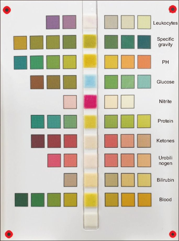 Artificial Intelligence in Diagnostics: Enhancing Urine Test Accuracy Using a Mobile Phone-Based Reading System.