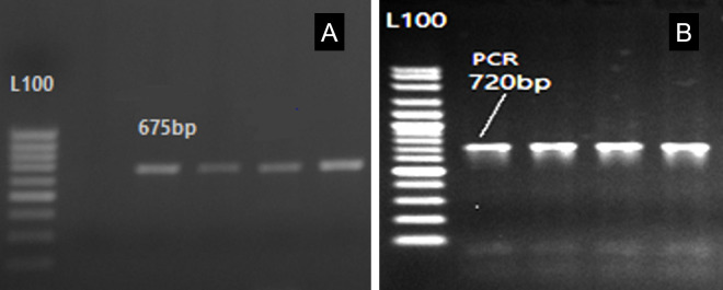 Fatty acids profile in Awassi sheep milk affected by some genes' single and combined effects.