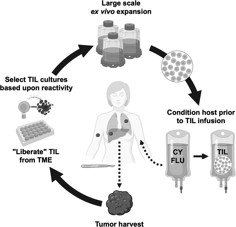 Optimizing TIL therapy for uveal melanoma: lessons learned and unlearned from cutaneous melanoma.