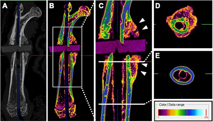 Development of a novel rat long-bone nonunion model and efficacy evaluation of a prostaglandin EP4 selective agonist (AKDS001) combined with iliac bone grafting.