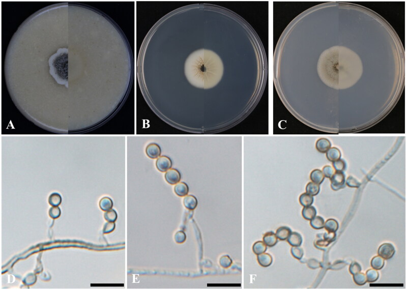 <i>Microascus microspora</i> sp. nov. and <i>Tolypocladium terrae</i> sp. nov.; Two Novel Fungal Species Isolated from Soil in Korea.