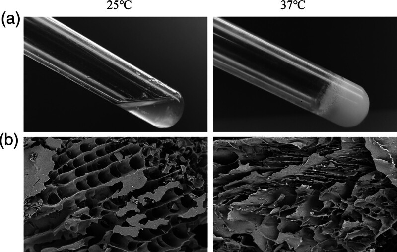 A dual thermo/pH-sensitive hydrogel as 5-Fluorouracil carrier for breast cancer treatment.