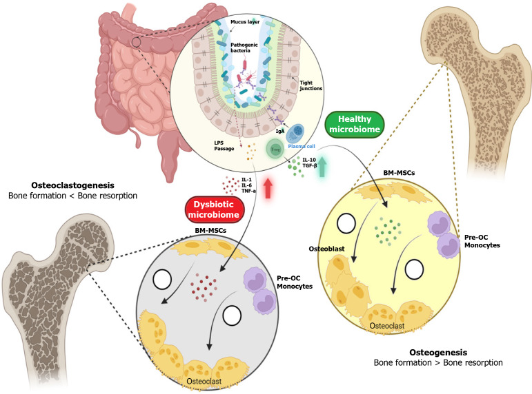 Cross-talks between osteoporosis and gut microbiome.